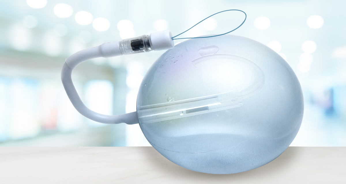 O que é o balão gástrico, afinal? - Spatz3 - Balão Intragástrico Ajustável